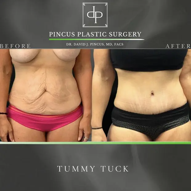 Transformed and confident!