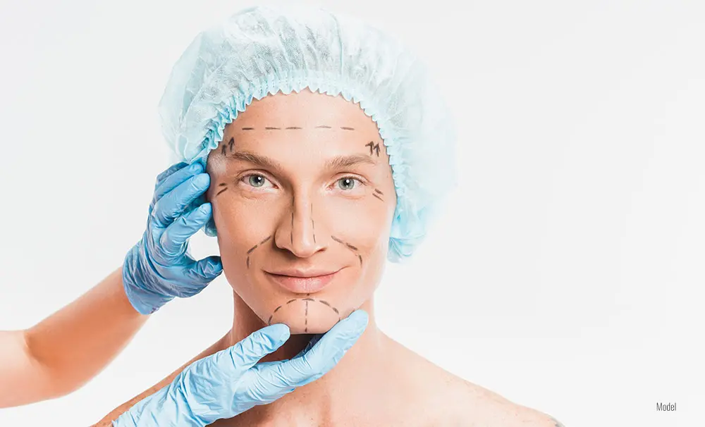 Male with marking on face before getting plastic surgery