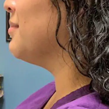 Define-Patient--Case-Study-7205 | After Define