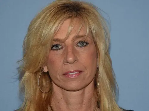 Facelift--Case-Study-4682 | After Facelift