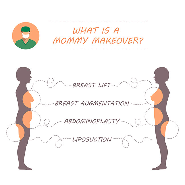 A Mommy Makeover usually consists of some combination of breast lift, breast augmentation, abdominoplasty, and liposuction.