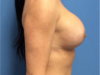 After Image