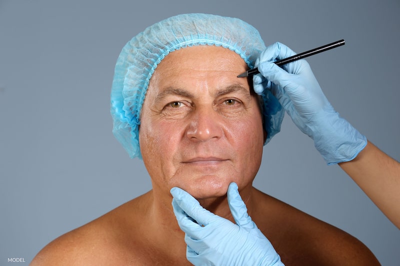 Older man being prepared for a facelift.