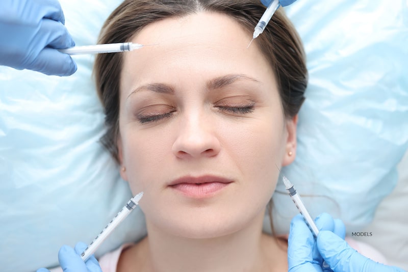 A woman lays on a pillow while four needles containing dermal fillers are pointed at her face.