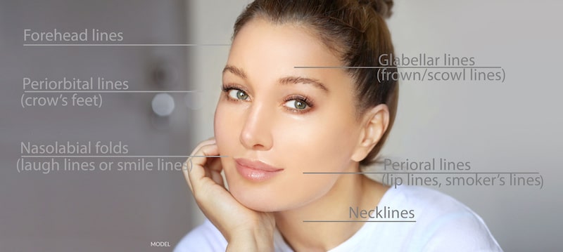 Pretty woman with great skin illustrating the different areas of the face and the kinds of wrinkles that appear there.