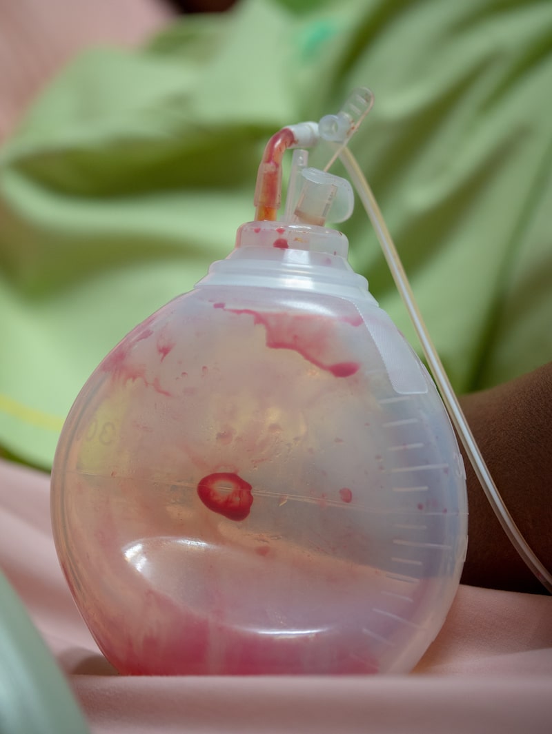 Close-up of a drain used during surgery recovery.