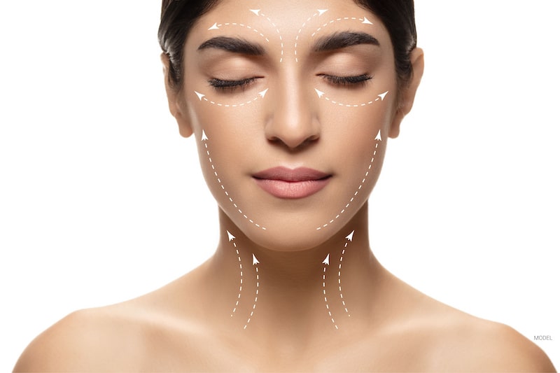 White lines mark the areas of a woman's face that can be addressed with comprehensive facial rejuvenation.