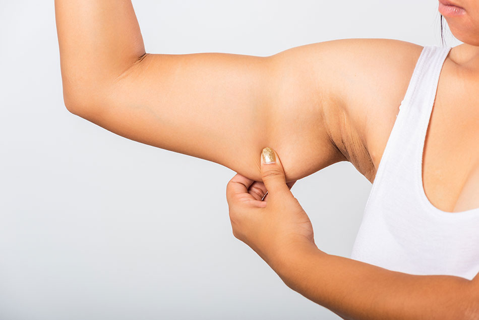 Woman in sleeveless top pulling on sagging skin on the underside of her arm.