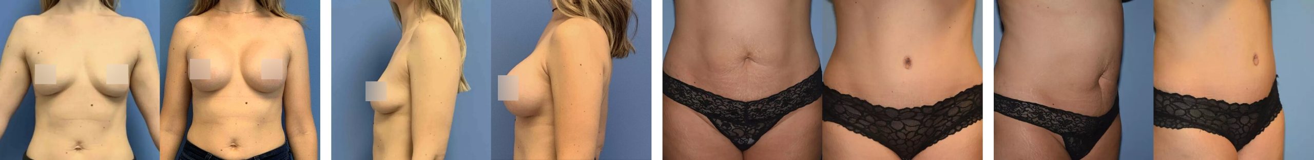 Before & Afters Patient Photos