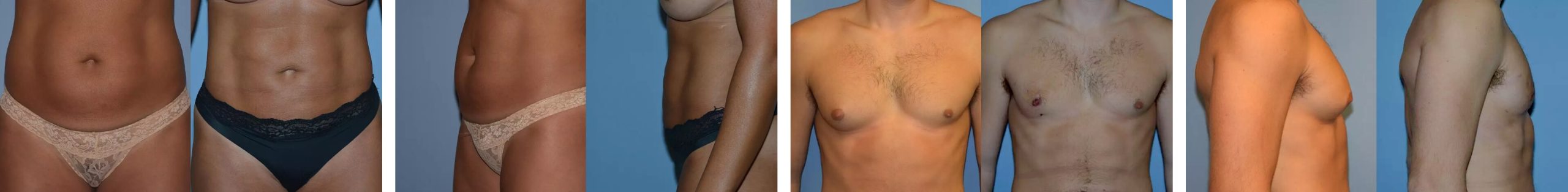 Before & Afters Patient Photos