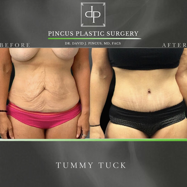 Transformed and confident!
