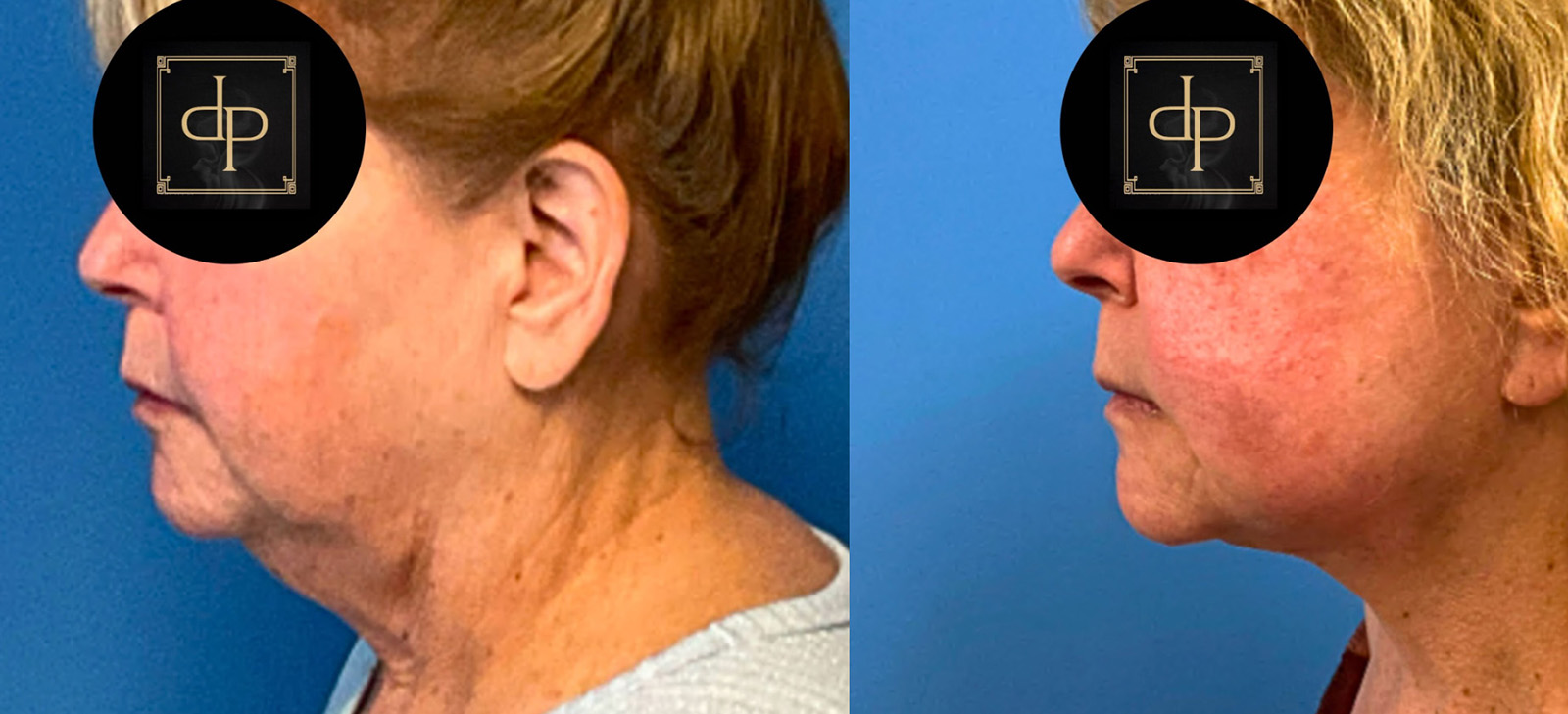 Actual patient results