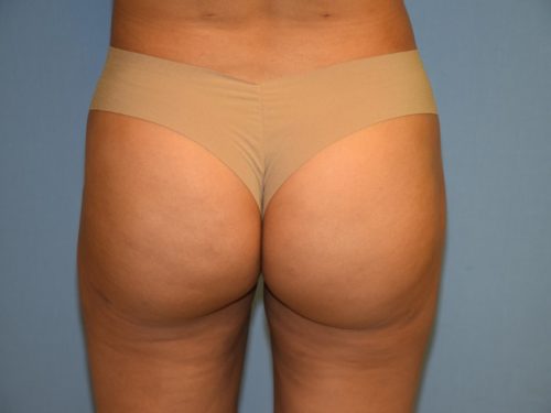 After Image