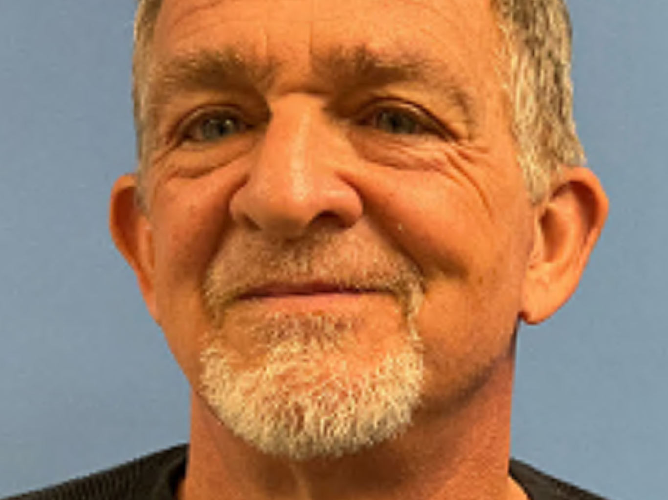 Neck-Lift--Case-3919 | After Face