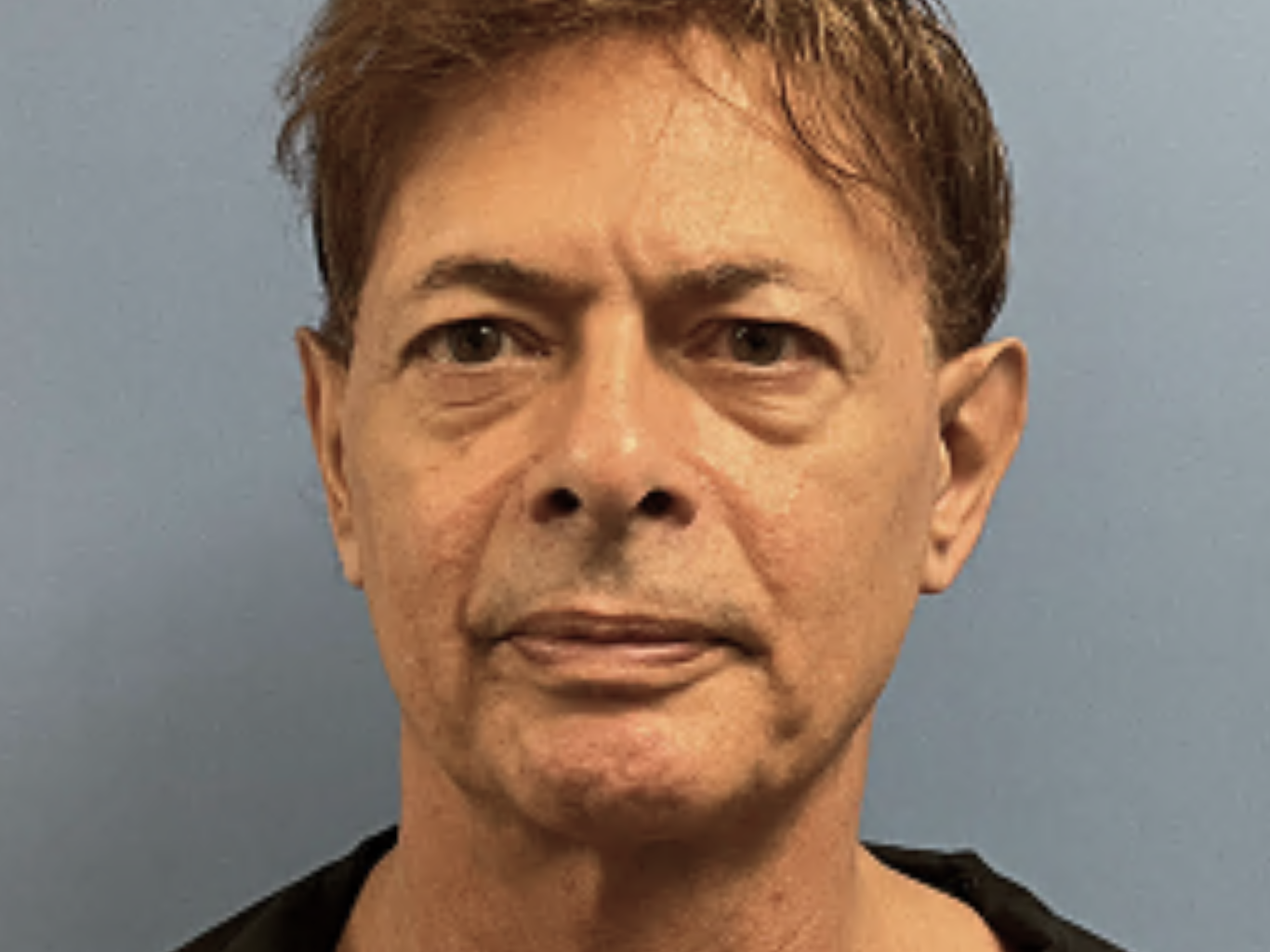 Facial-Rejuvenation---8211--Lower-Face-and-Neck-Lift--Blepharoplasty | Before Face