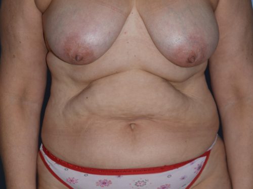 Before Image