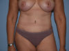 After Image