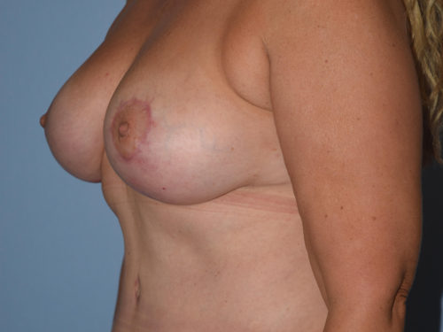 After Image