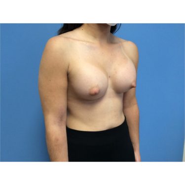 After Image