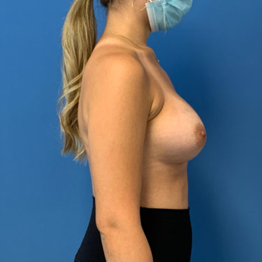 After Image