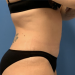 After Image