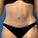 After Image