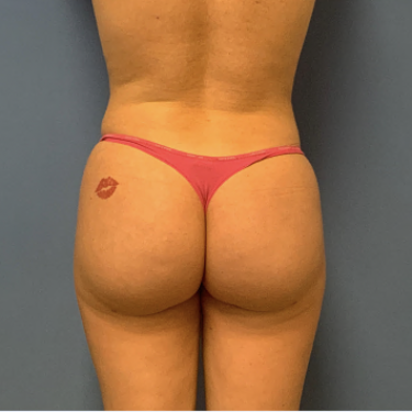 After Image