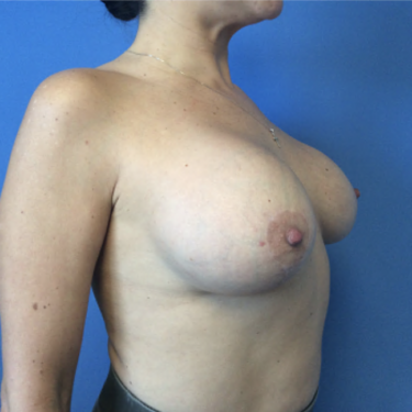 After Image