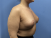After Image