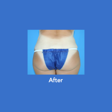 After Image