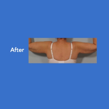 After Image