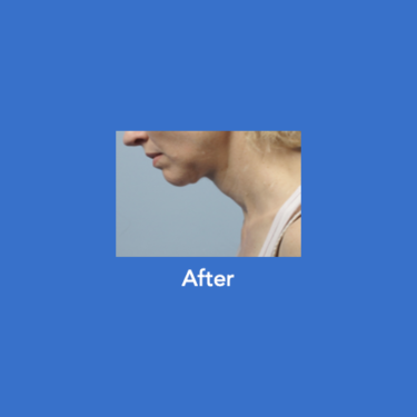After Image