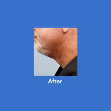 After Image