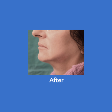 After Image