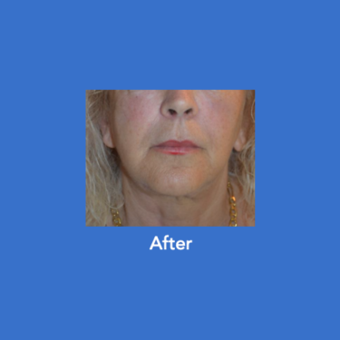 After Image