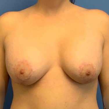 After Image