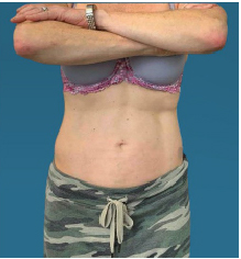 After Image