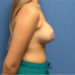 After Image