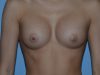 After Image