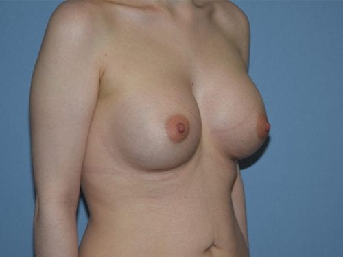 After Image