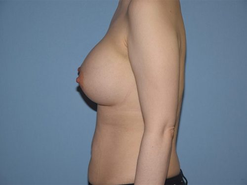 After Image