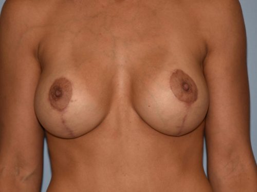 After Image