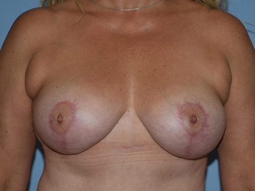After Image