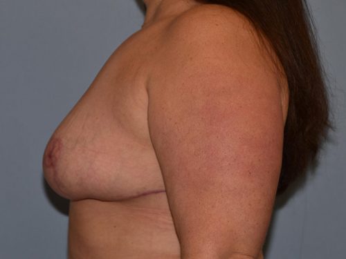 After Image