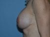 After Image