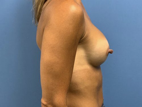 After Image