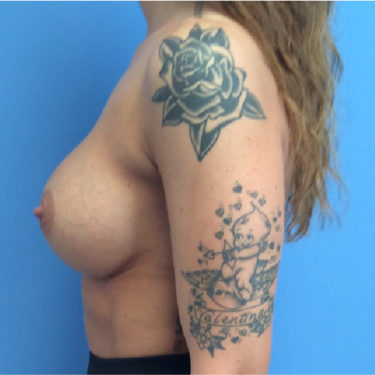 After Image