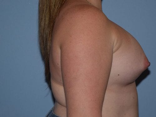 After Image