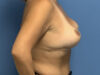 After Image