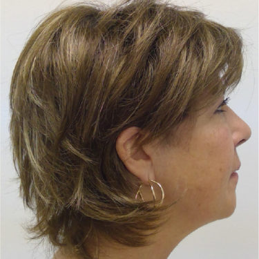 After Image